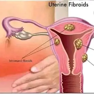 Product image attachment 3 - Yoni detox egg, healthy vagina and uterus